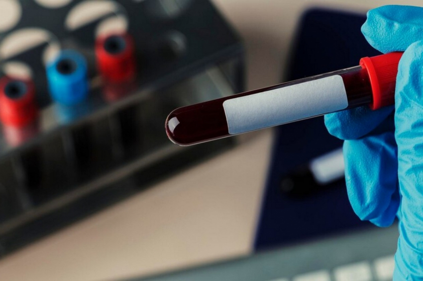 Врач-эндокринолог Терушкин назвал самые бесполезные анализы — деньги на ветер