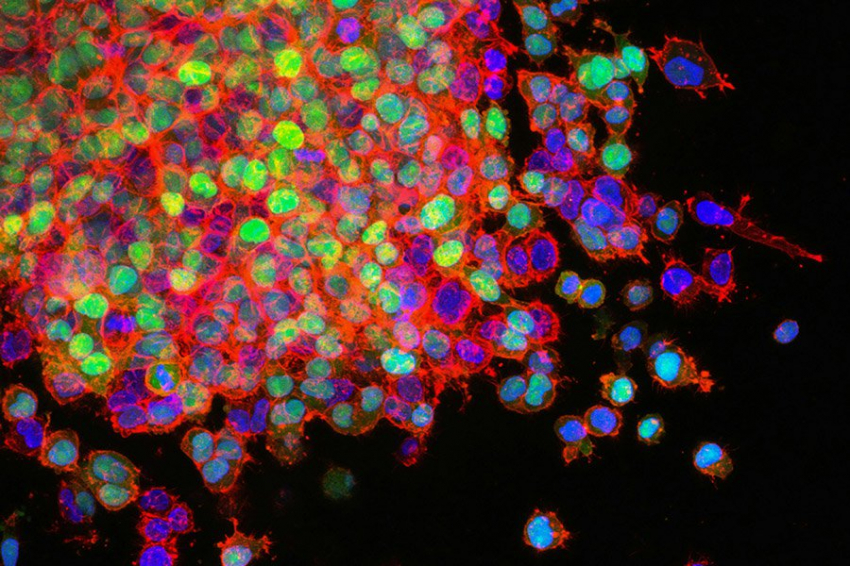 Immunity: установлено, раковые клетки эксплуатируют иммунную систему