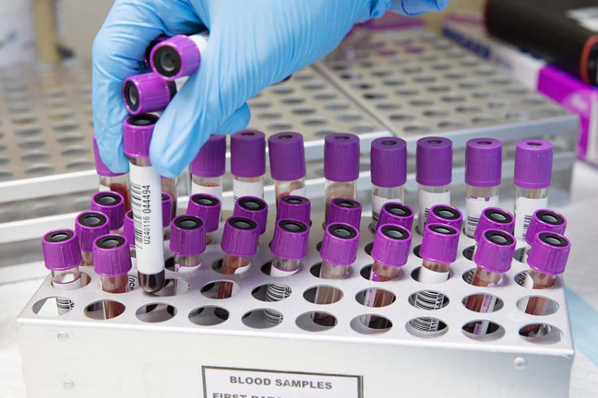 Nature: онкология может быть вызвана обратимыми эпигенетическими изменениями