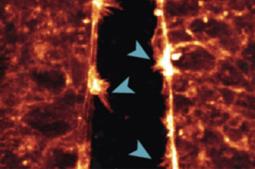 Новая технология позволяет наблюдать за развитием плода в реальном времени
