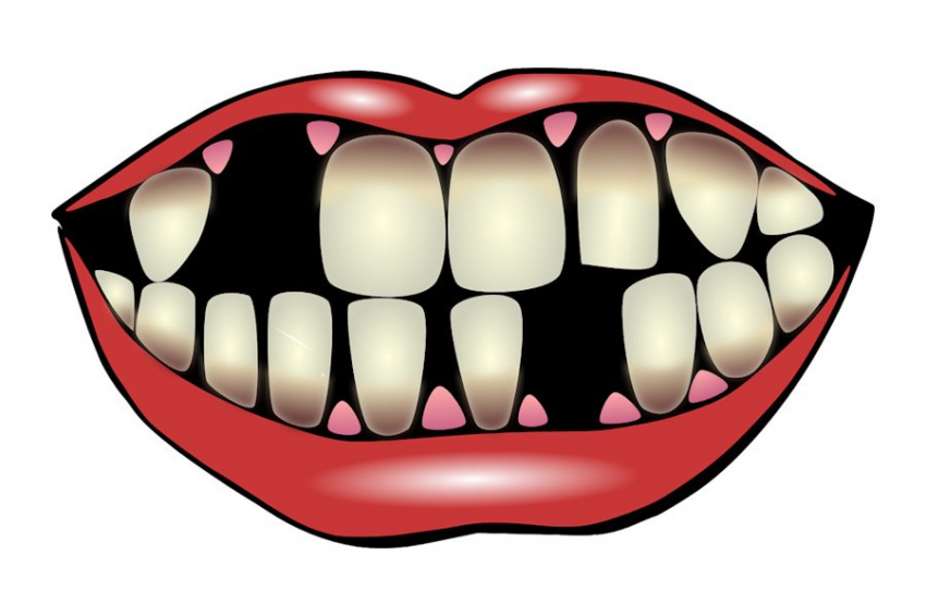 JoE: потеря зубов увеличивает риск смерти от ССЗ в 1,66 раз