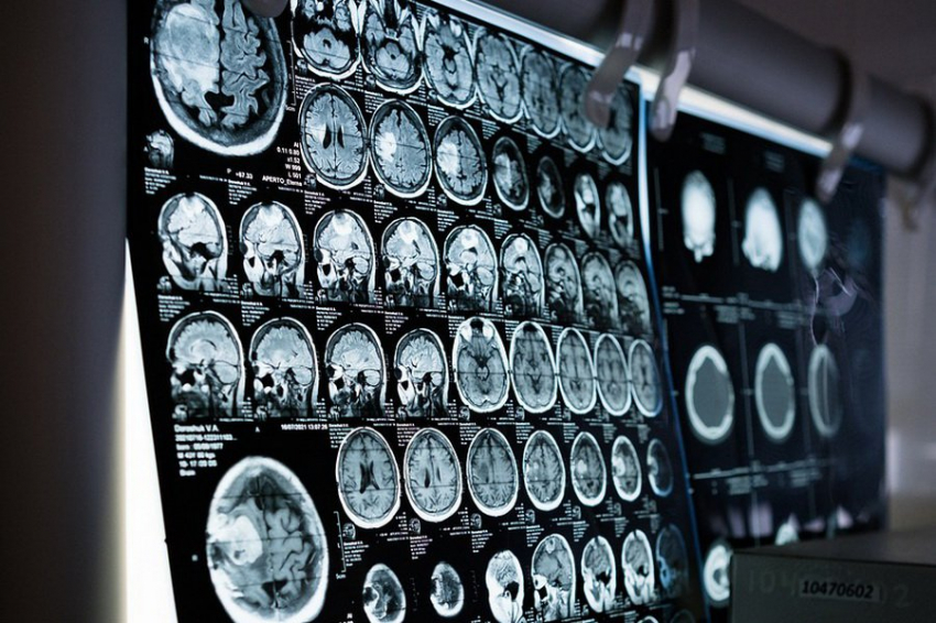 Нейрофизиологи из США создали автономную систему стимуляции мозга