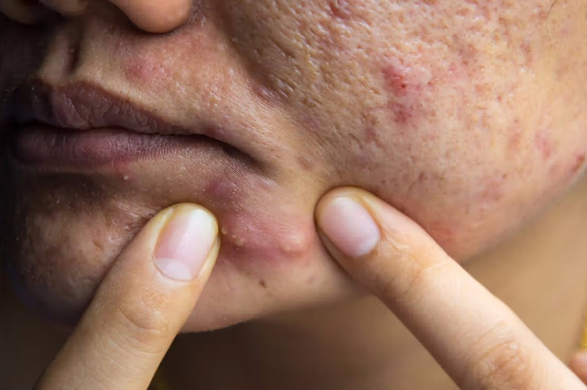 Шишки под кожей могут быть первым сигналом о раке