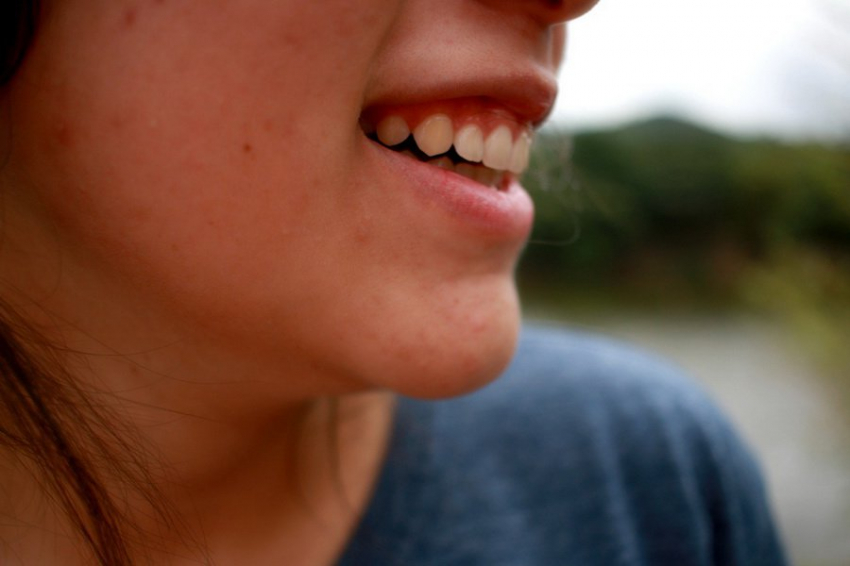 Ученые назвали страну, в которой подростки чаще других страдают от акне