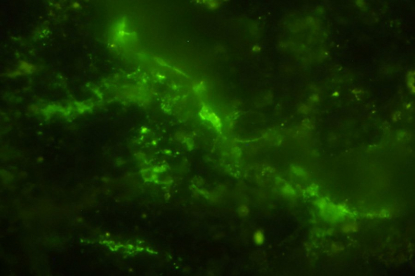 Микробиологи обнаружили живые микробы в породе возрастом 2 миллиарда лет