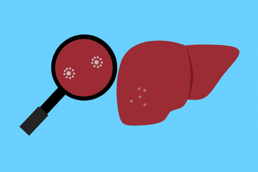 Воздействие на определенный ген может стать ключом к лечению гепатита B, C и D