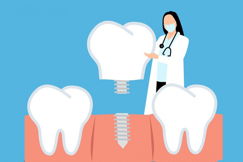 Протез под давлением: ученые раскрыли тайну прочности съемных зубных конструкций